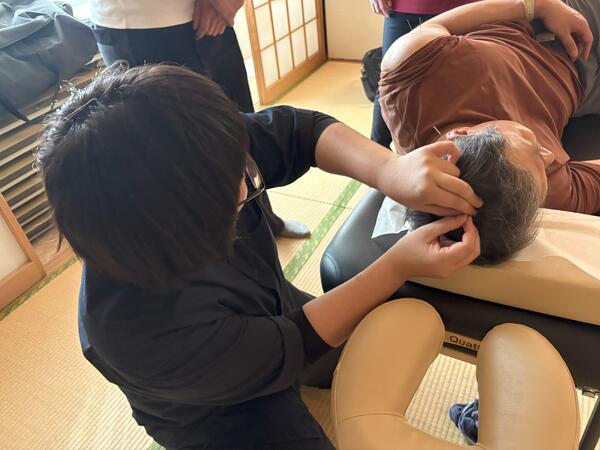 頭部鍼治療.jpg